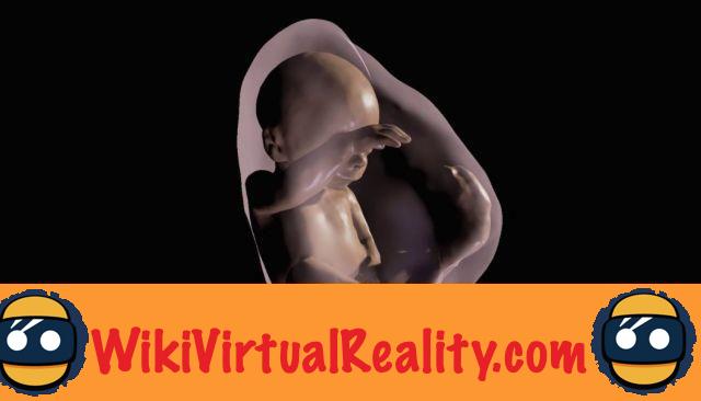 VR Ultrasound - A technology to see the fetus in virtual reality