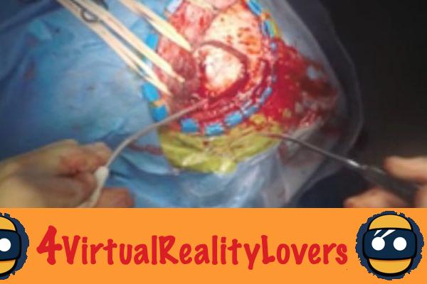 Anteprima mondiale: un impressionante video di neurochirurgia a 360 gradi